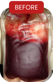 Treatment Klinik Holicare ( Website ) (2) Treatment Klinik Holicare ( Website ) (2)